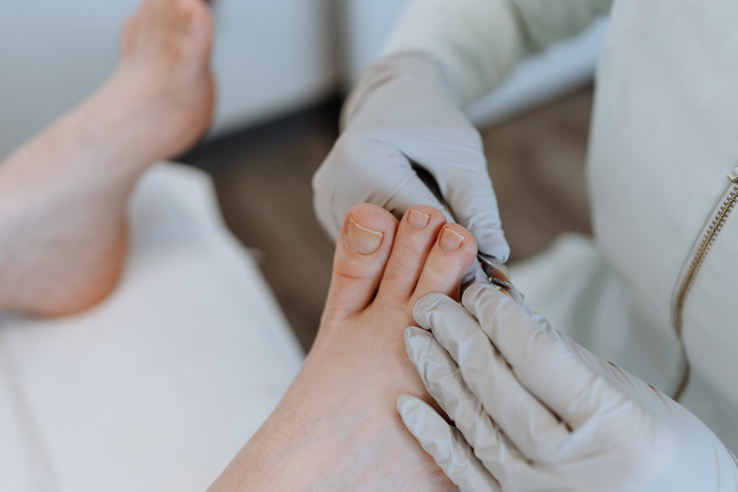 Foot care nurse working on toes of a foot